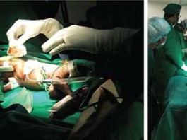 අඩු බර ළදරුවෙකුට කරාපිටිය රෝහලේදී කළ හදවත් සැත්කම
