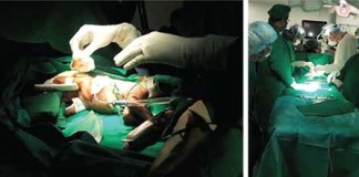 අඩු බර ළදරුවෙකුට කරාපිටිය රෝහලේදී කළ හදවත් සැත්කම